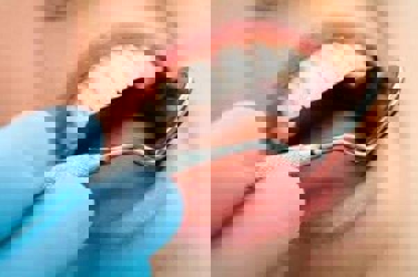 معاینه دندان تا ۷سالگی کودک را از ارتودنسی و جراحی آینده نجات می‌دهد