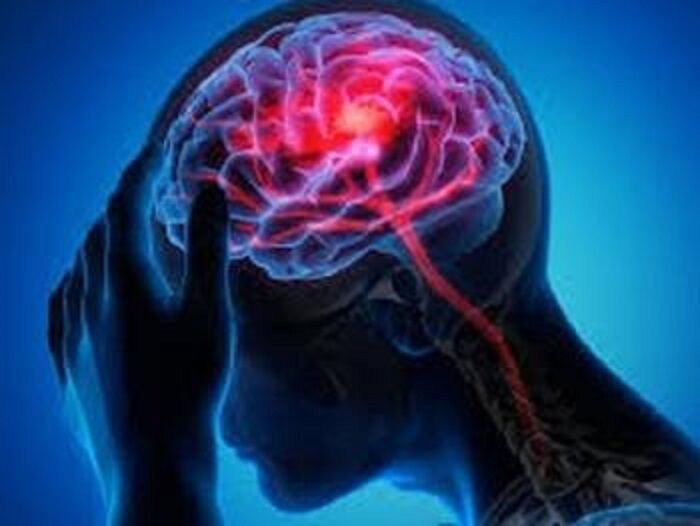 آیا سالمند مبتلا به آلزایمر به مراقبت شبانه روزی نیاز دارد؟